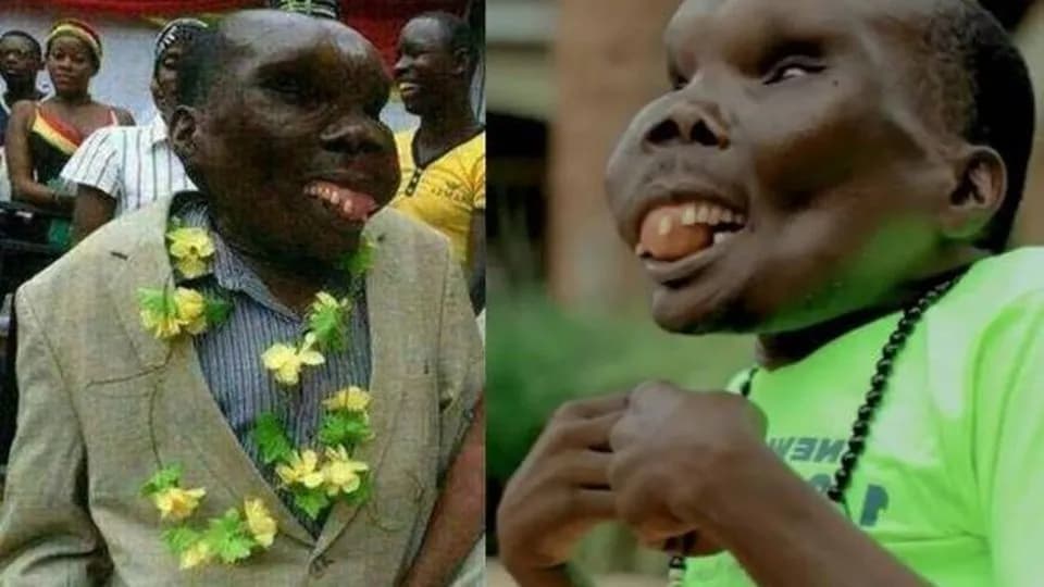 Najbrzydszy chłopak świata: Kim jest i dlaczego jest znany?