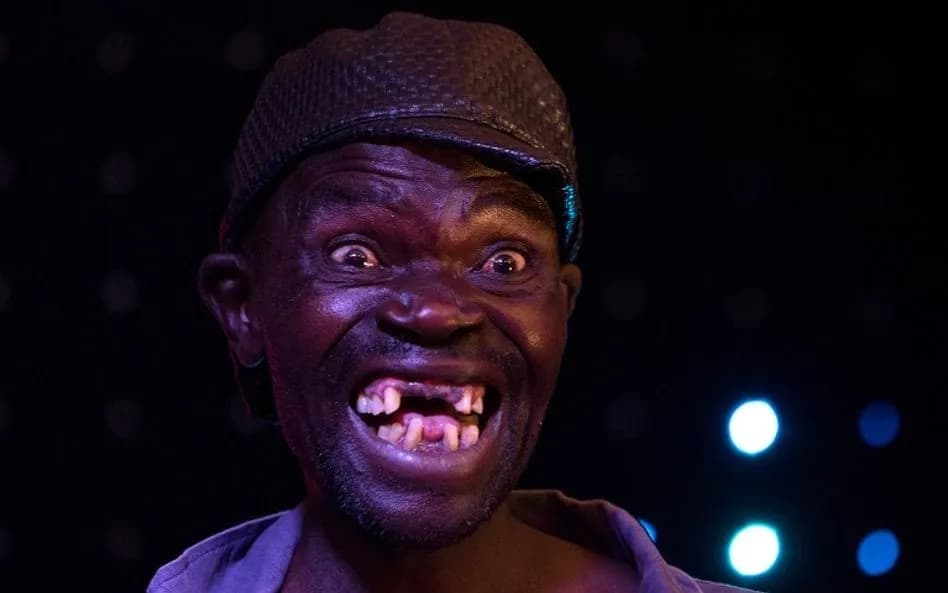 Najbrzydszy chłopak świata: Kim jest i dlaczego jest znany?